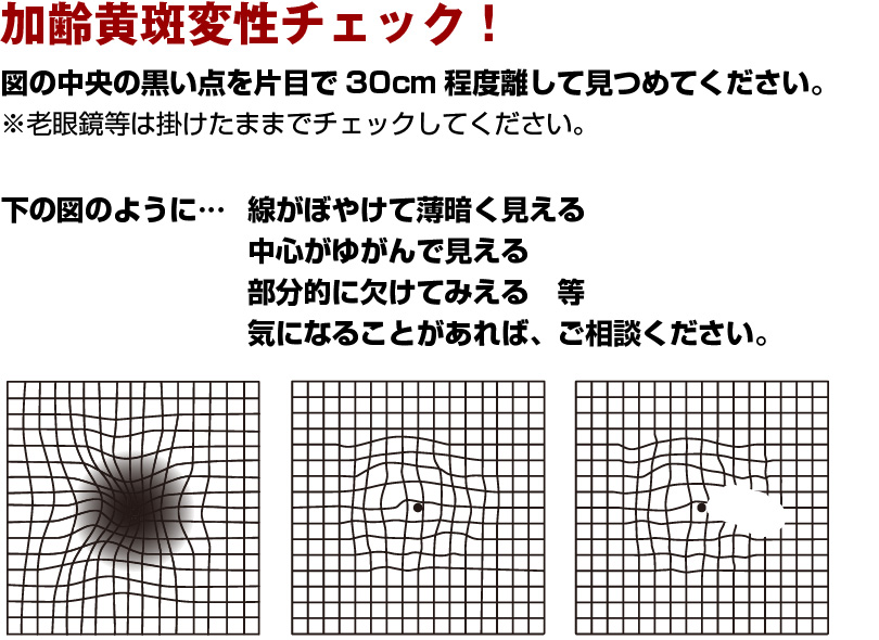 加齢黄斑変性チェック